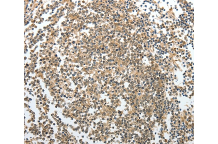 Immunohistochemistry - PRMT2 Antibody from Signalway Antibody (35888) - Antibodies.com
