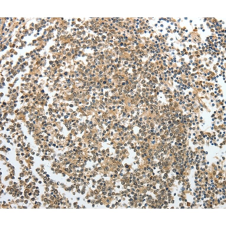 Immunohistochemistry - PRMT2 Antibody from Signalway Antibody (35888) - Antibodies.com