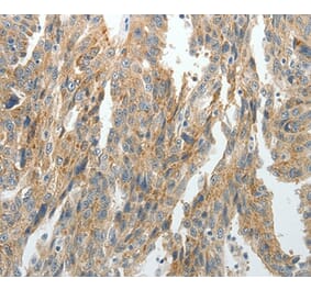 Immunohistochemistry - PRDX5 Antibody from Signalway Antibody (35891) - Antibodies.com