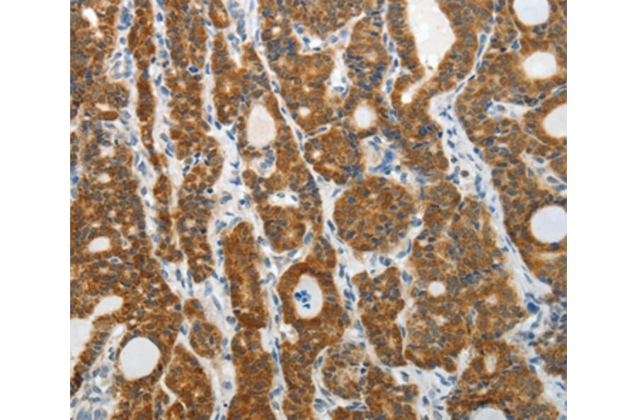 Immunohistochemistry - PRDX5 Antibody from Signalway Antibody (35891) - Antibodies.com