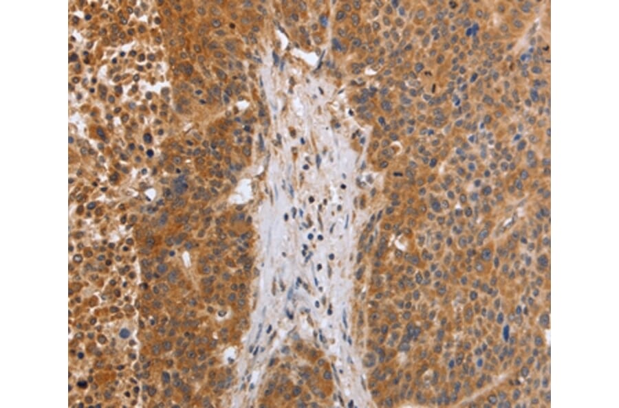 Immunohistochemistry - EGLN3 Antibody from Signalway Antibody (35893) - Antibodies.com