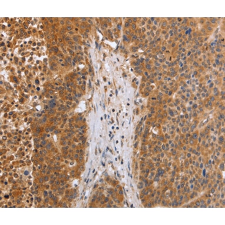 Immunohistochemistry - EGLN3 Antibody from Signalway Antibody (35893) - Antibodies.com