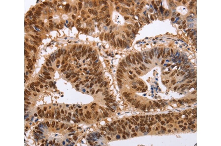 Immunohistochemistry - PSMD8 Antibody from Signalway Antibody (35895) - Antibodies.com