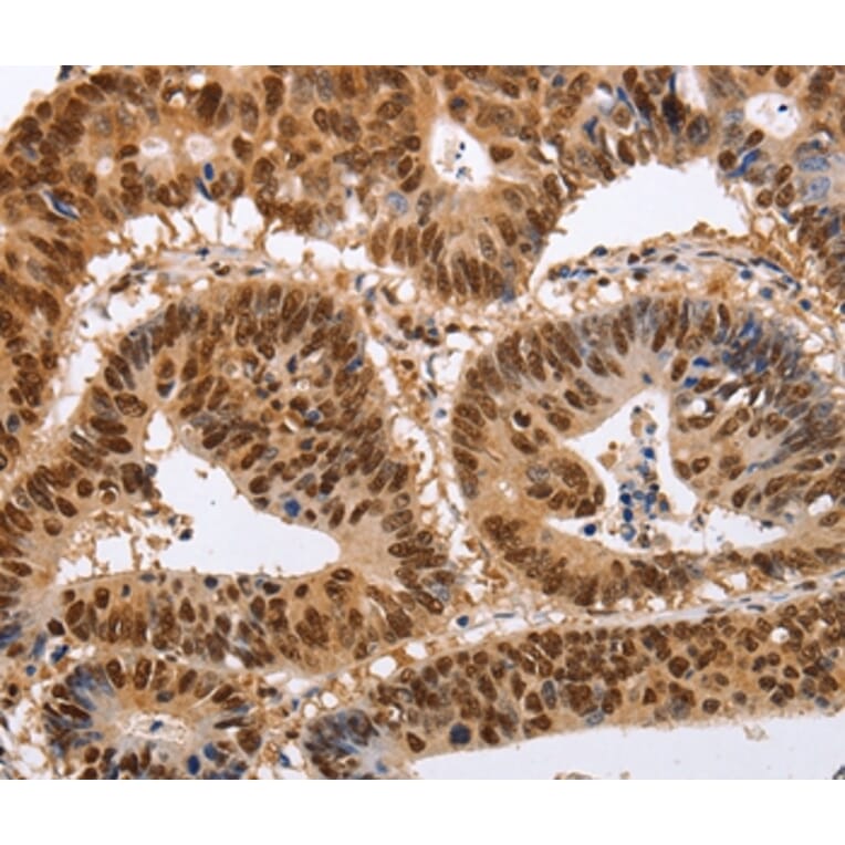 Immunohistochemistry - PSMD8 Antibody from Signalway Antibody (35895) - Antibodies.com