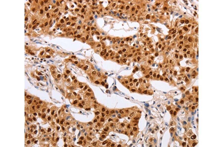 Immunohistochemistry - PSMD8 Antibody from Signalway Antibody (35895) - Antibodies.com