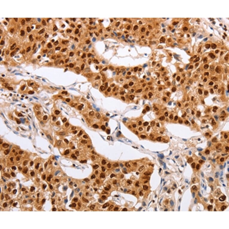 Immunohistochemistry - PSMD8 Antibody from Signalway Antibody (35895) - Antibodies.com