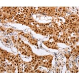 Immunohistochemistry - PSMD8 Antibody from Signalway Antibody (35895) - Antibodies.com