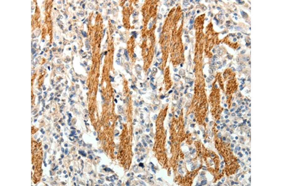 Immunohistochemistry - PTHLH Antibody from Signalway Antibody (35899) - Antibodies.com