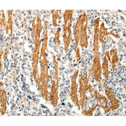Immunohistochemistry - PTHLH Antibody from Signalway Antibody (35899) - Antibodies.com