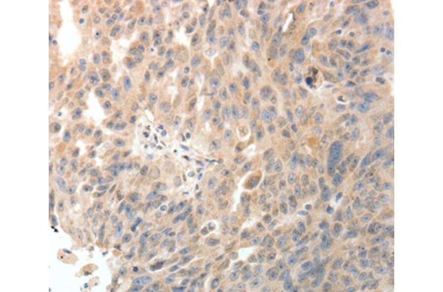 Immunohistochemistry - PTHLH Antibody from Signalway Antibody (35899) - Antibodies.com