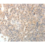 Immunohistochemistry - PTHLH Antibody from Signalway Antibody (35899) - Antibodies.com