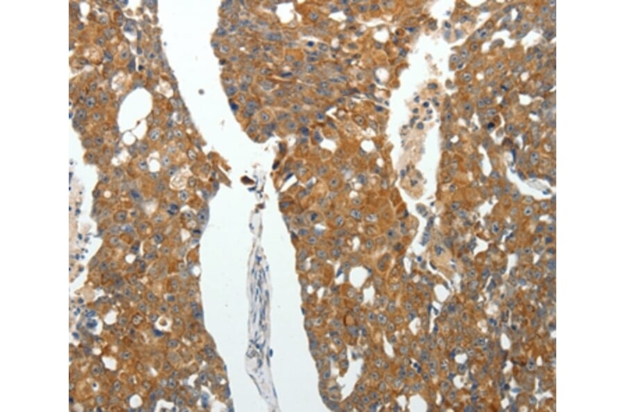 Immunohistochemistry - ROCK1 Antibody from Signalway Antibody (35907) - Antibodies.com