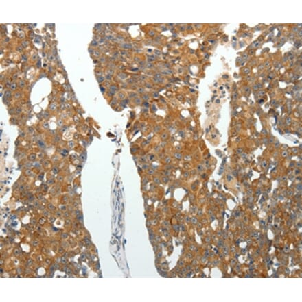 Immunohistochemistry - ROCK1 Antibody from Signalway Antibody (35907) - Antibodies.com