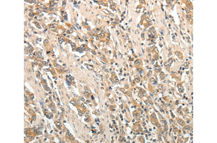 Immunohistochemistry - ROCK1 Antibody from Signalway Antibody (35907) - Antibodies.com