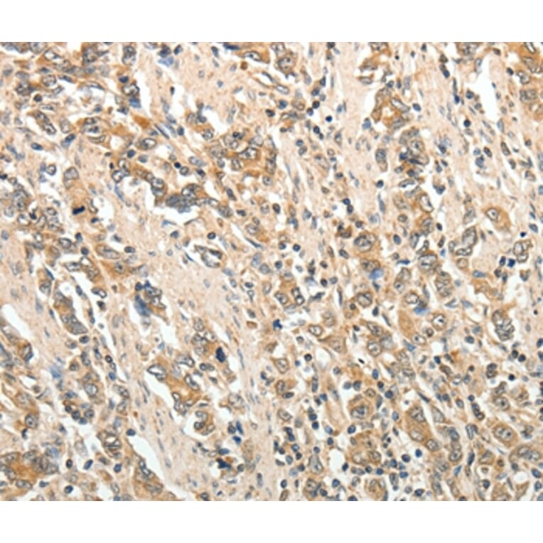 Immunohistochemistry - ROCK1 Antibody from Signalway Antibody (35907) - Antibodies.com