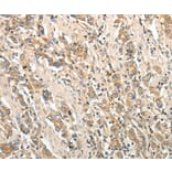 Immunohistochemistry - ROCK1 Antibody from Signalway Antibody (35907) - Antibodies.com