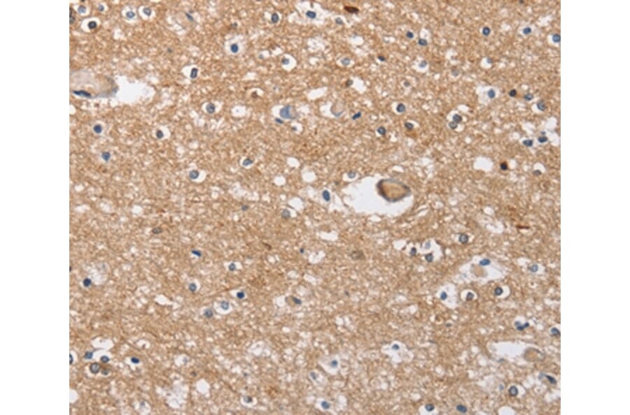 Immunohistochemistry - SOCS2 Antibody from Signalway Antibody (35922) - Antibodies.com