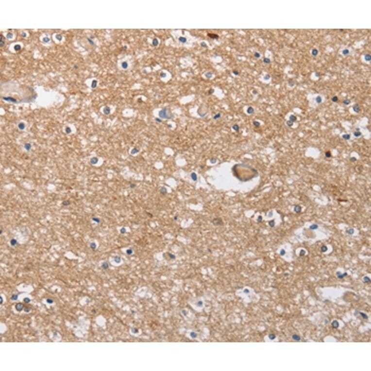 Immunohistochemistry - SOCS2 Antibody from Signalway Antibody (35922) - Antibodies.com