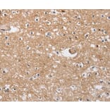 Immunohistochemistry - SOCS2 Antibody from Signalway Antibody (35922) - Antibodies.com