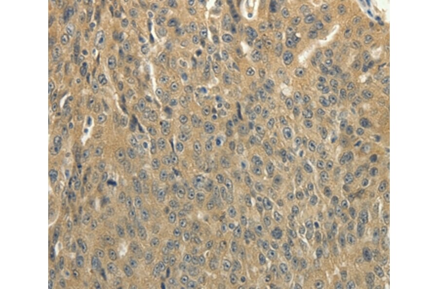 Immunohistochemistry - SOCS5 Antibody from Signalway Antibody (35923) - Antibodies.com