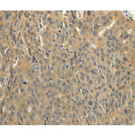 Immunohistochemistry - SOCS5 Antibody from Signalway Antibody (35923) - Antibodies.com