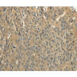 Immunohistochemistry - SOCS5 Antibody from Signalway Antibody (35923) - Antibodies.com