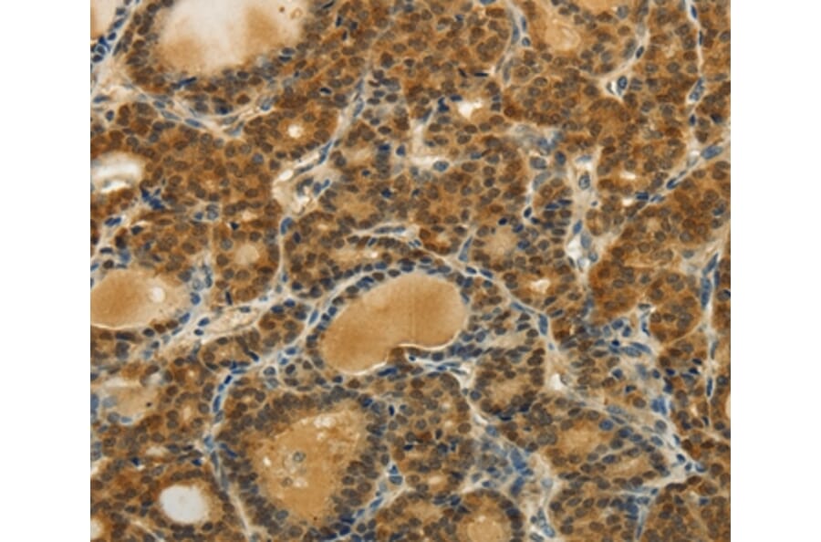 Immunohistochemistry - SOCS5 Antibody from Signalway Antibody (35923) - Antibodies.com