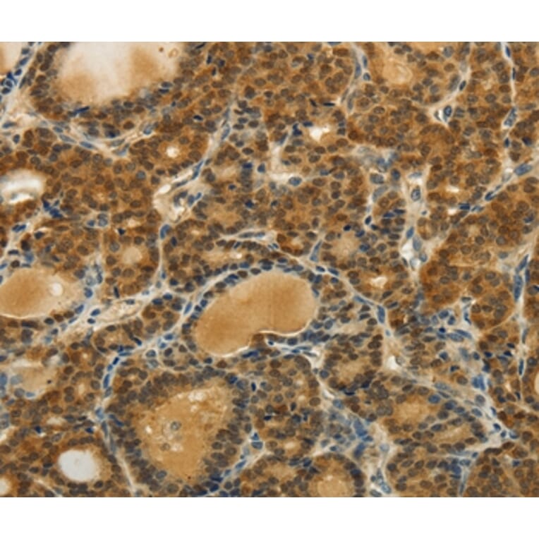 Immunohistochemistry - SOCS5 Antibody from Signalway Antibody (35923) - Antibodies.com
