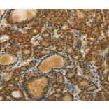 Immunohistochemistry - SOCS5 Antibody from Signalway Antibody (35923) - Antibodies.com