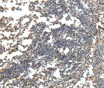Immunohistochemical analysis of paraffin-embedded Human tonsil tissue using #35927 at dilution 1/30.
