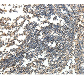 Immunohistochemistry - SPAG8 Antibody from Signalway Antibody (35927) - Antibodies.com