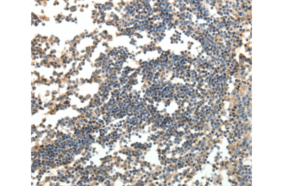 Immunohistochemistry - SPAG8 Antibody from Signalway Antibody (35927) - Antibodies.com