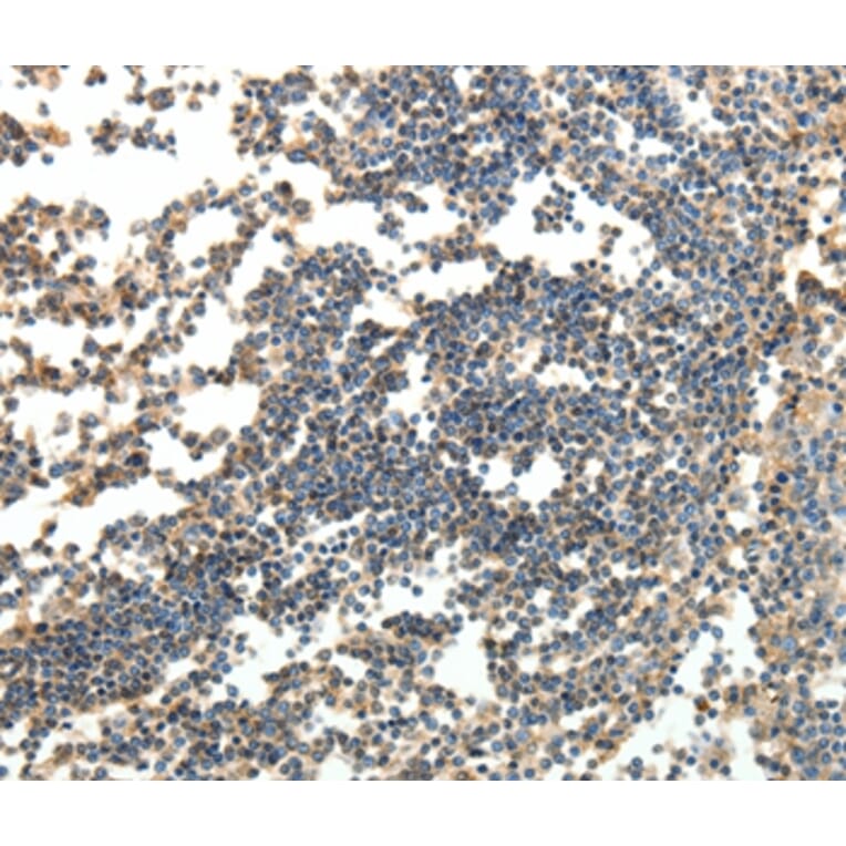 Immunohistochemistry - SPAG8 Antibody from Signalway Antibody (35927) - Antibodies.com