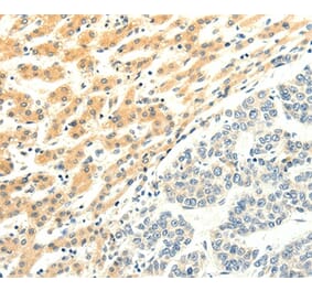 Immunohistochemistry - SPAG5 Antibody from Signalway Antibody (35928) - Antibodies.com