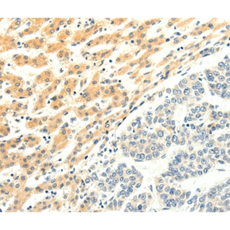 Immunohistochemistry - SPAG5 Antibody from Signalway Antibody (35928) - Antibodies.com