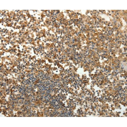Immunohistochemistry - SFTPD Antibody from Signalway Antibody (35929) - Antibodies.com