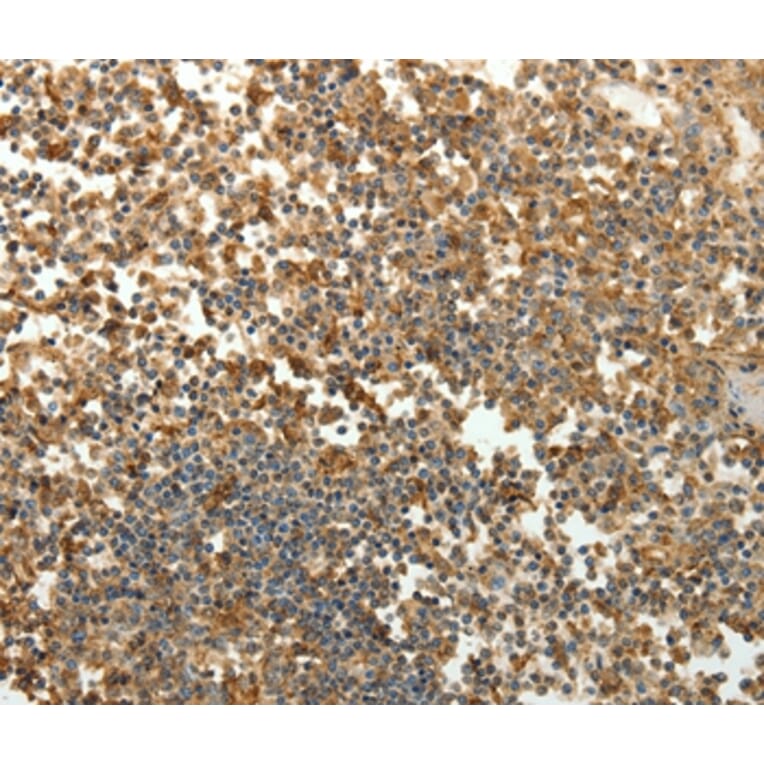 Immunohistochemistry - SFTPD Antibody from Signalway Antibody (35929) - Antibodies.com