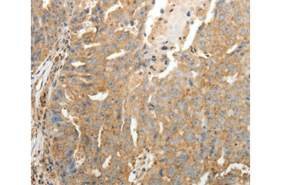 Immunohistochemistry - SFTPD Antibody from Signalway Antibody (35929) - Antibodies.com