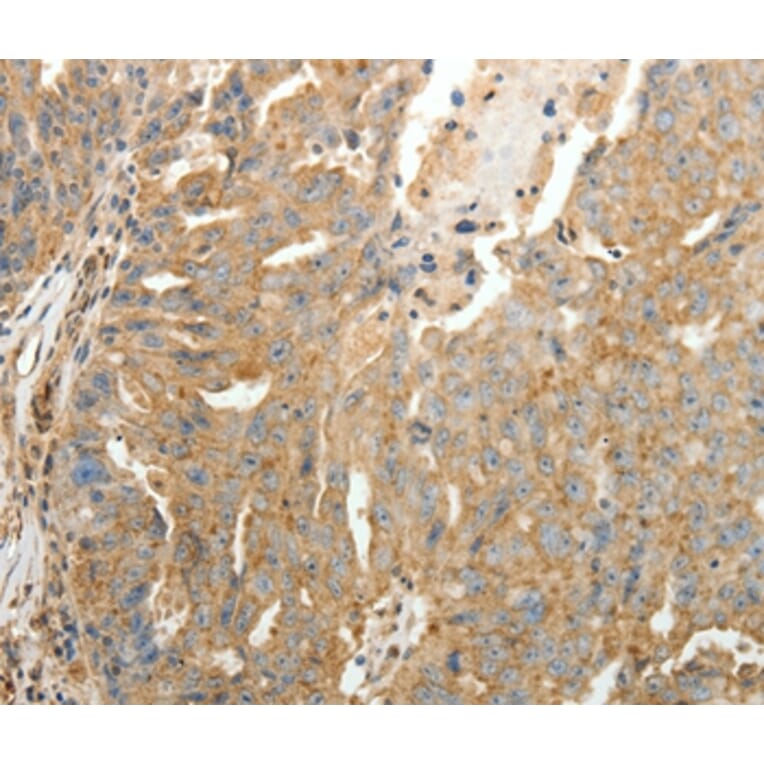 Immunohistochemistry - SFTPD Antibody from Signalway Antibody (35929) - Antibodies.com