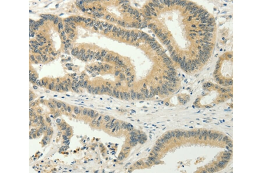 Immunohistochemistry - SPIN4 Antibody from Signalway Antibody (35930) - Antibodies.com