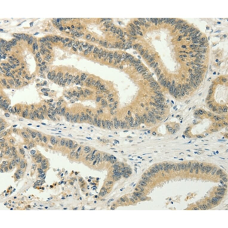 Immunohistochemistry - SPIN4 Antibody from Signalway Antibody (35930) - Antibodies.com