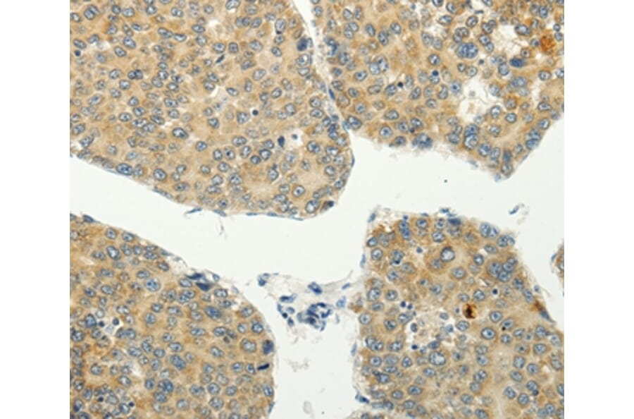 Immunohistochemistry - SPIN4 Antibody from Signalway Antibody (35930) - Antibodies.com