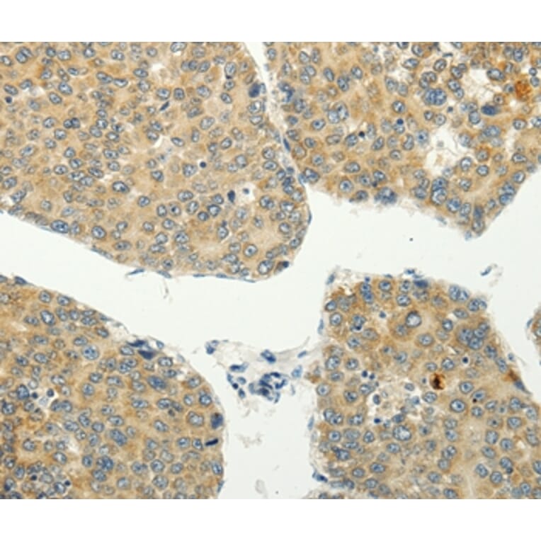 Immunohistochemistry - SPIN4 Antibody from Signalway Antibody (35930) - Antibodies.com