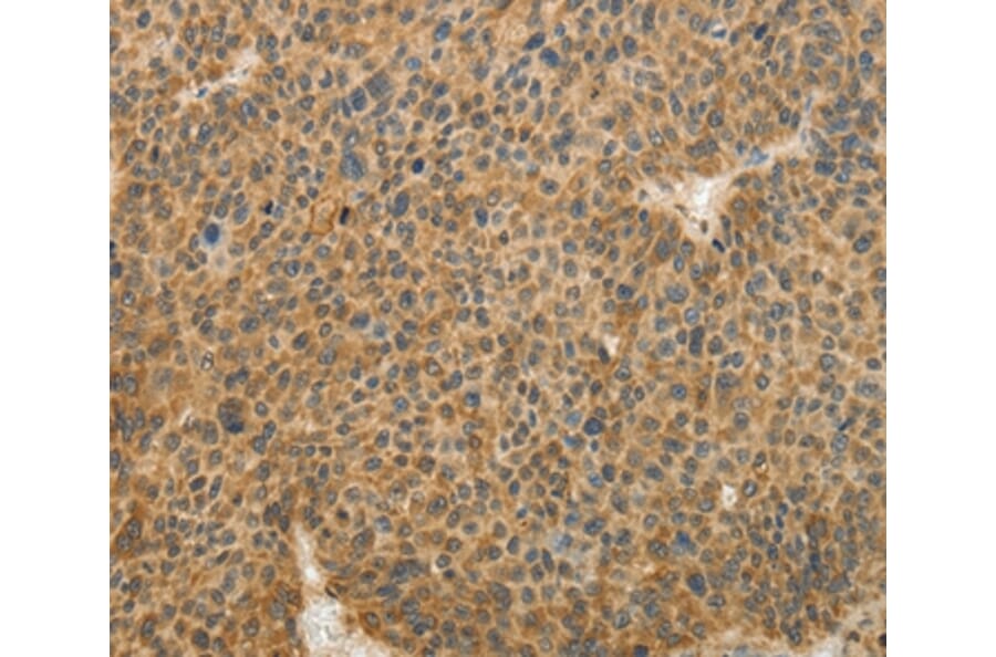 Immunohistochemistry - TFPI2 Antibody from Signalway Antibody (35956) - Antibodies.com