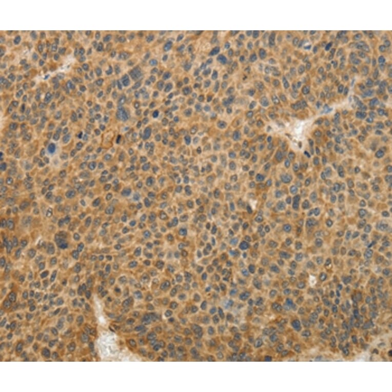 Immunohistochemistry - TFPI2 Antibody from Signalway Antibody (35956) - Antibodies.com