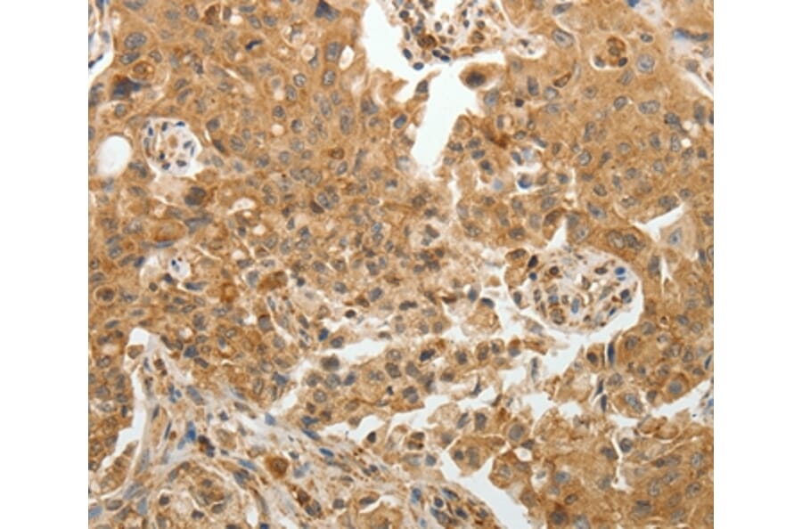 Immunohistochemistry - TFPI2 Antibody from Signalway Antibody (35956) - Antibodies.com