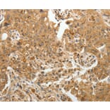 Immunohistochemistry - TFPI2 Antibody from Signalway Antibody (35956) - Antibodies.com