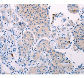 Immunohistochemistry - TEKT4 Antibody from Signalway Antibody (35960) - Antibodies.com