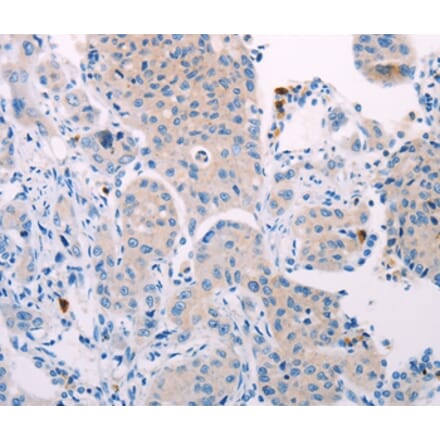 Immunohistochemistry - TEKT4 Antibody from Signalway Antibody (35960) - Antibodies.com