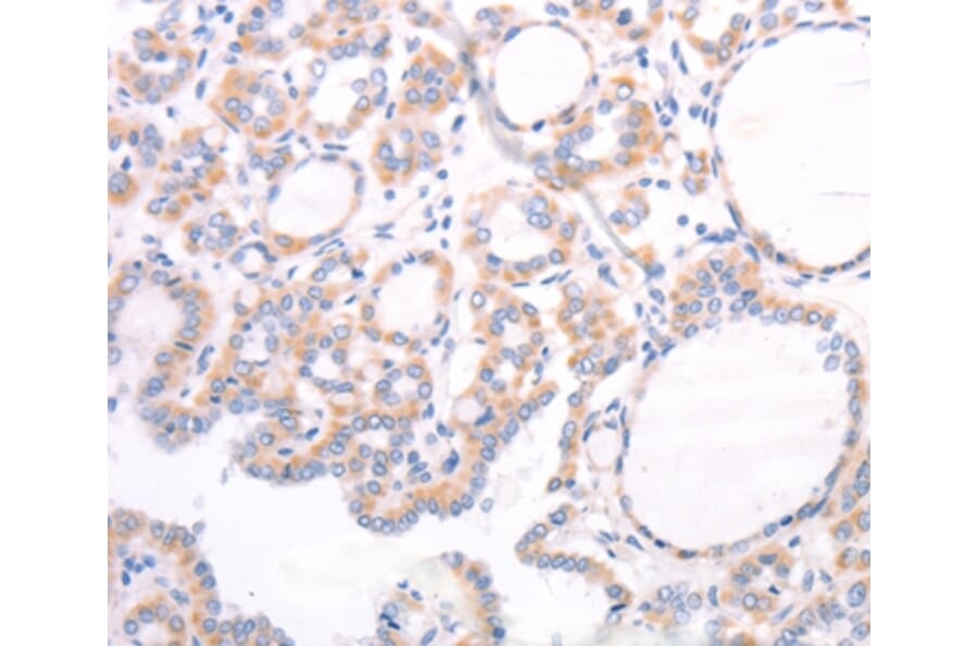 Immunohistochemistry - TRPC7 Antibody from Signalway Antibody (35976) - Antibodies.com